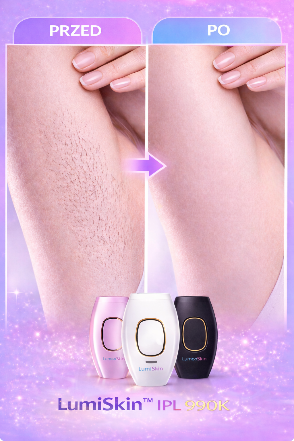 LumiSkin™ IPL 990K